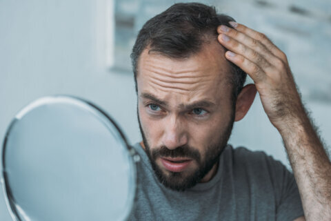 FDA approves first oral tablet for alopecia treatment
