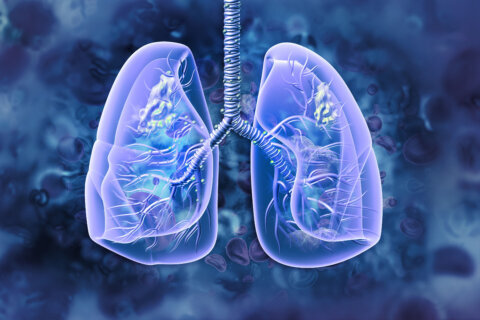 Why researchers are asking more Black patients to join DC lung cancer clinical trials